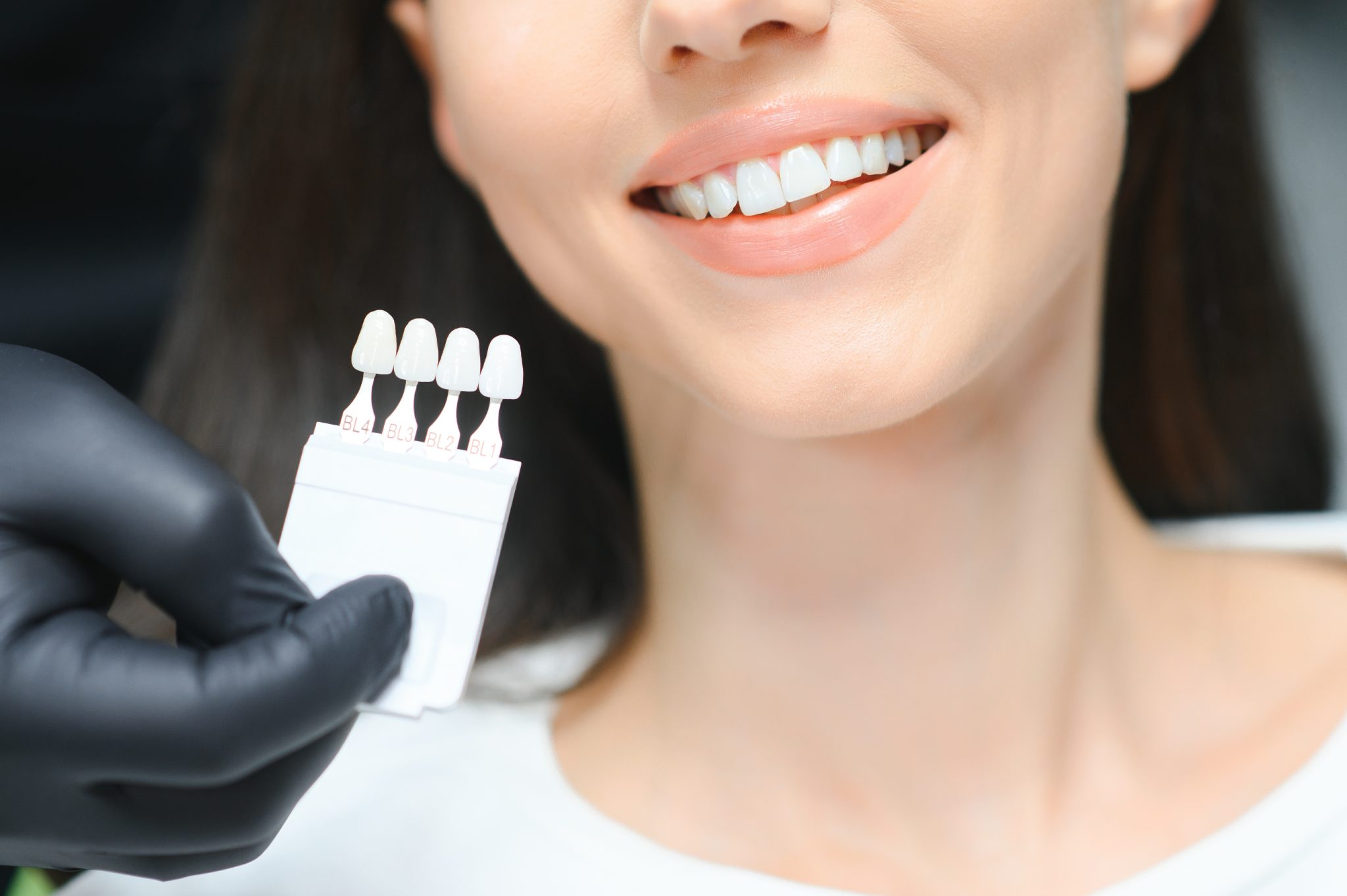 Patient getting veneers with Dentaventures