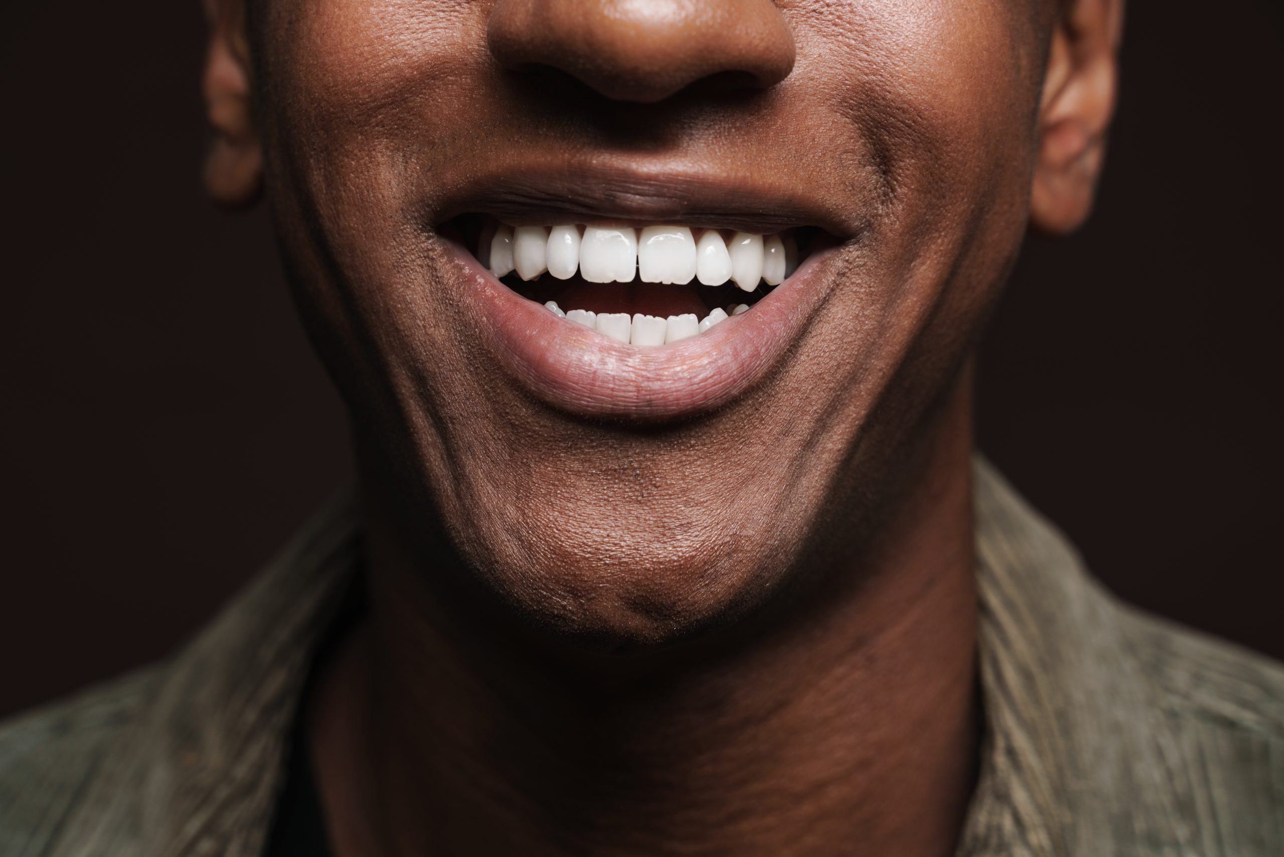 Patient who got dental implants with Dentaventures